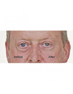 Augenkontur-Serum... 2